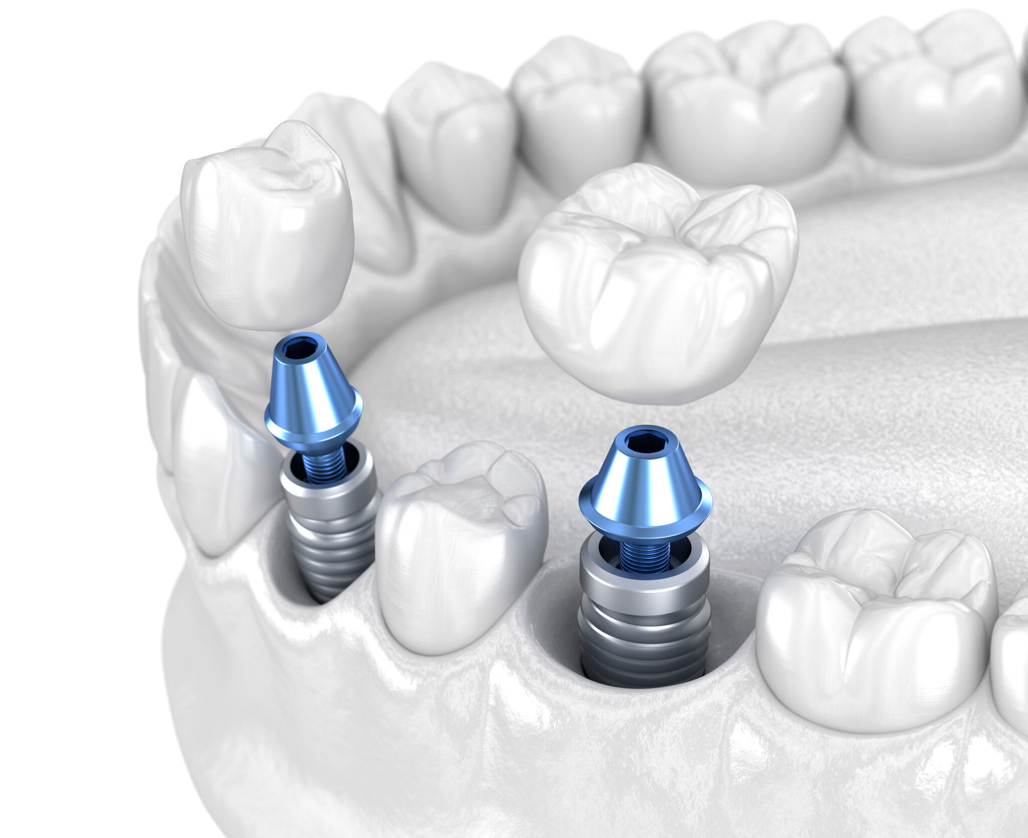 Stoller Dental Laboratory