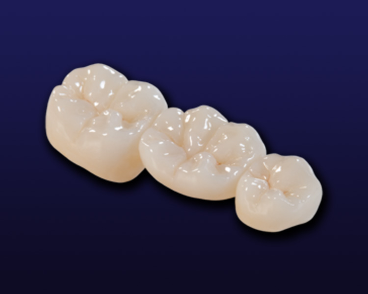 Zirconia Full Contour