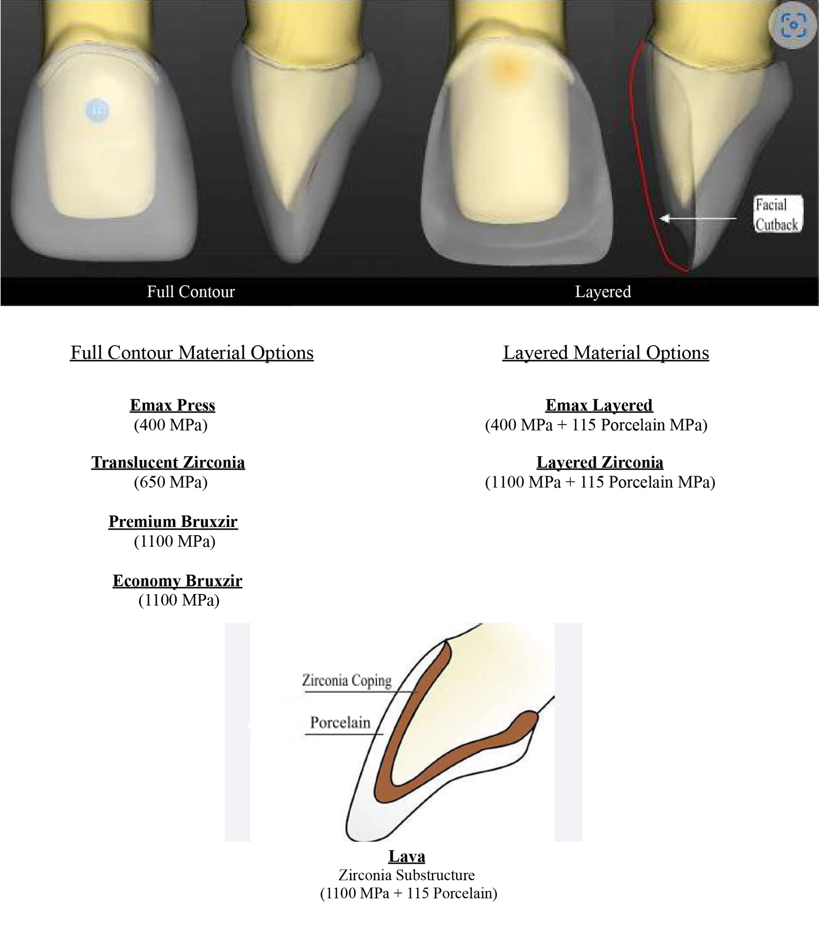Frequently Asked Questions - Stoller Dental Lab